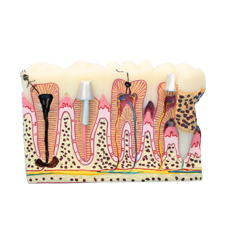 thumbnail image 2 of Dental Typodont Model With Removable Teeth 32 Teeth Model For Dental 2 of 13