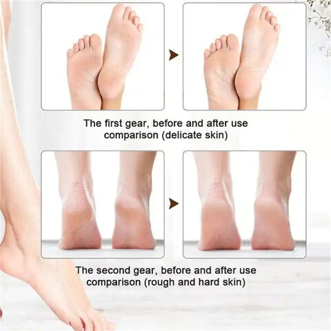 Electric Foot Callus Remover Kit-Electric Foot Grinder Rechargeable Automatic Foot Peeler Pr??fessional Pedicure Tools Female Foot Care Portable Foot