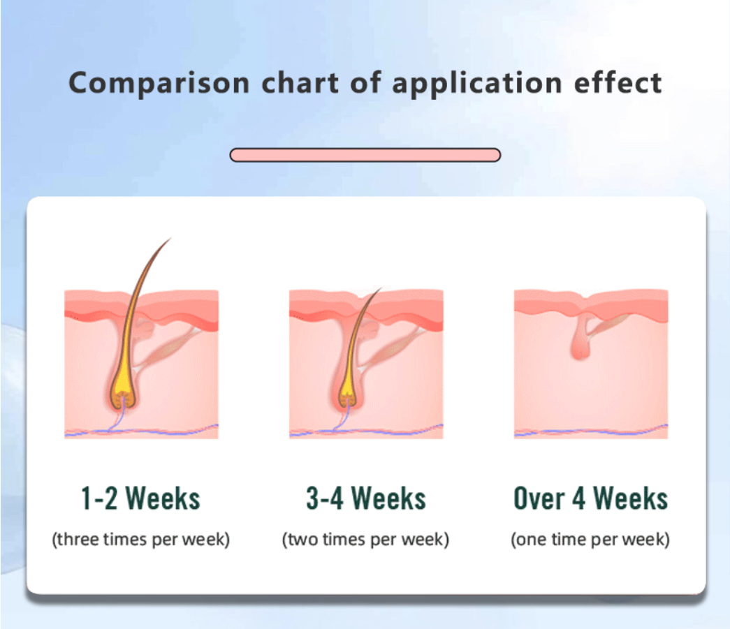 Buy Wholesale China Ipl Laser Permanent Ipl Hair Removal Home Ice ...