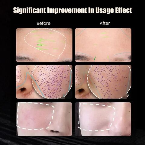 Photonen therapie Maske Infrarot Rotlicht Haut verjüngung Anti-Falten Aufhellen LED Gesichts maske 7 Farblicht Phototherapie Masken