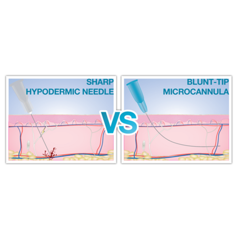 Sterile medizinische Mikrokanüle Feine Nadel 18G 22G 25G 38mm 50mm 70mm stumpfe Kanüle für injizierbares Hyaluron