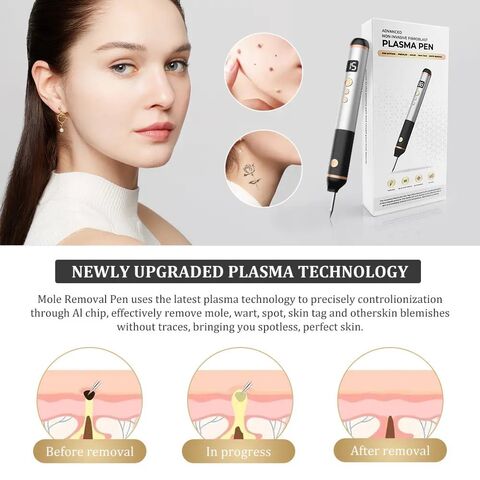 Pluma de Plasma para Eliminación de Lunares y Tratamiento No Quirúrgico de Manchas en la Piel, Imperfecciones y Eliminación de Lunares, Terapia de Plasma Efectiva
