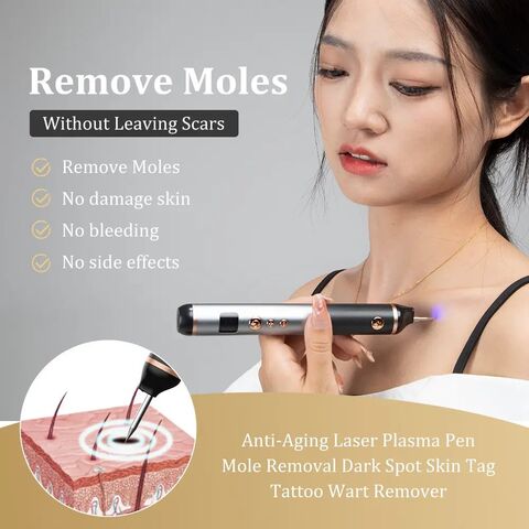 Pluma de Plasma para Eliminación de Lunares y Tratamiento No Quirúrgico de Manchas en la Piel, Imperfecciones y Eliminación de Lunares, Terapia de Plasma Efectiva