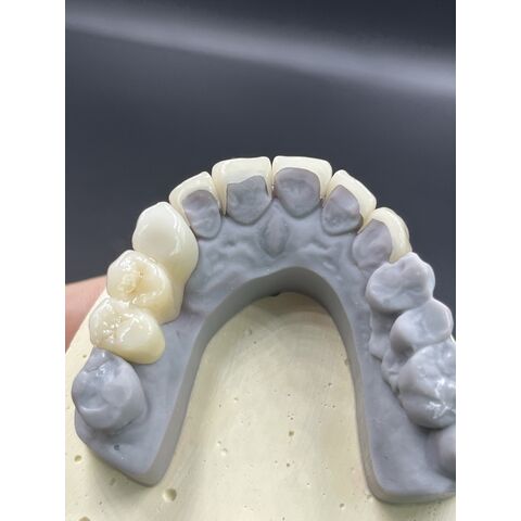 Heißer Verkauf von Zahnveneers, Dentallabor, kundenspezifische Zirkonkronen, Brücken/Implantate, Prothesen für ästhetische Anforderungen.