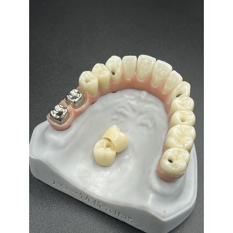 Heißer Verkauf von Zahnveneers, Dentallabor, kundenspezifische Zirkonkronen, Brücken/Implantate, Prothesen für ästhetische Anforderungen.