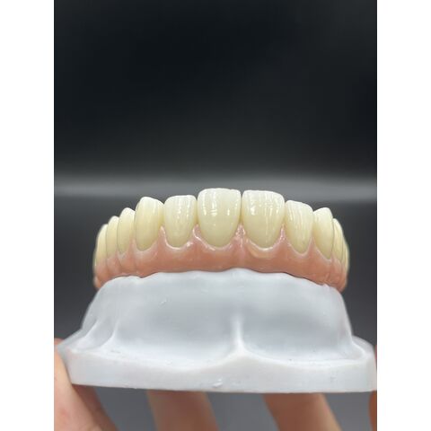Heißer Verkauf von Zahnveneers, Dentallabor, kundenspezifische Zirkonkronen, Brücken/Implantate, Prothesen für ästhetische Anforderungen.
