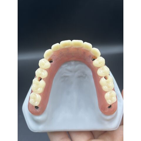 Heißer Verkauf von Zahnveneers, Dentallabor, kundenspezifische Zirkonkronen, Brücken/Implantate, Prothesen für ästhetische Anforderungen.