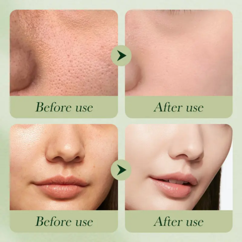 Set de Cuidado Facial Orgánico para Adultos: Antiedad, Blanqueador, Hidratante. Productos de Belleza con Vitamina C a Base de Aceite para Rostro y Ojos.