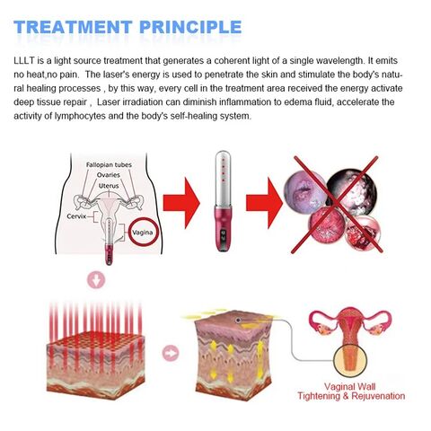Tongkat Pengencang Vagina untuk Kesehatan Intim & Panggul - Stimulasi, Kencangkan & Rejuvenasi untuk Meningkatkan Kepercayaan Diri & Kenyamanan