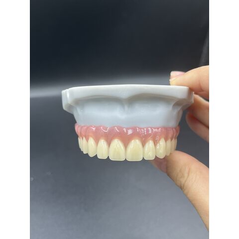 Heißer Verkauf von Zahnveneers, Dentallabor, kundenspezifische Zirkonkronen, Brücken/Implantate, Prothesen für ästhetische Anforderungen.