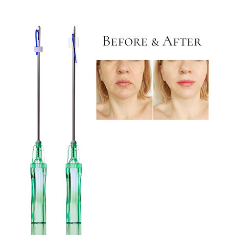 Resorbierbares 21g L W Kanülen Cog 4D PDO Fadenlifting zur Faltenentfernung und Hautverjüngung