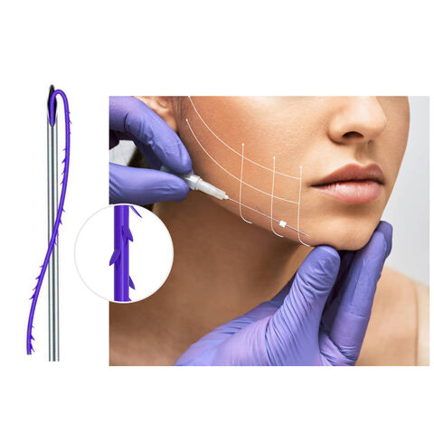 Resorbierbares 21g L W Kanülen Cog 4D PDO Fadenlifting zur Faltenentfernung und Hautverjüngung