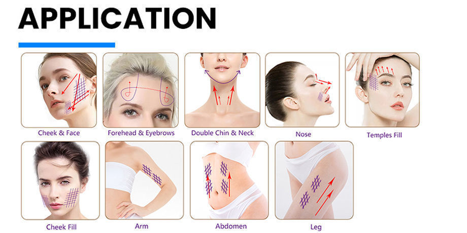 Barb Thread Beauty Thread 20g Product Lift Pdo Thread Body Pdo Thread ...