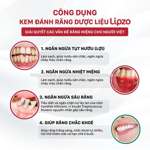 معجون أسنان Lipzo Gum Sensitive Protect للاستخدام المنزلي، 110 جرام، من الشركة المصنعة