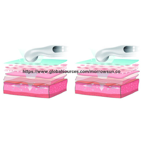 Ultrasonic Sound Wave Infrared Heat Therapy Joint Pain Relieve Medical Equipment Handheld Massager