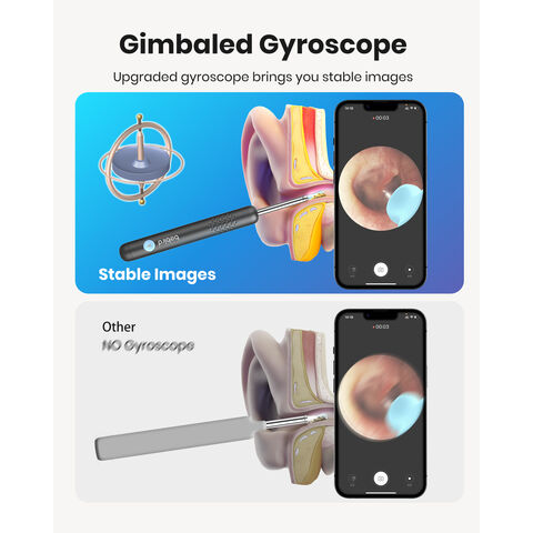 Otoscopio Inalámbrico OEM con Cámara HD, Iluminación LED y Control por APP para Visualización Mejorada del Canal Auditivo