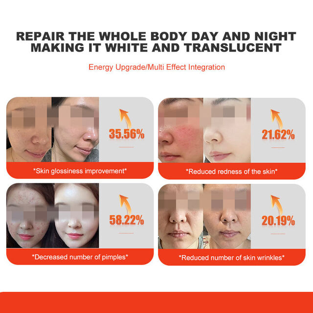 Máquina de Belleza LED PDT de 7 Colores - Terapia para Acné y Arrugas