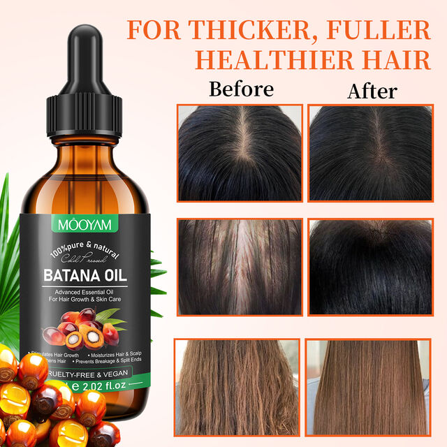 Huile Essentielle Avancée Stimule la Croissance des Cheveux, Hydrate Cheveux & Cuir Chevelu - Huile de Batana MOOYAM pour la Croissance et les Soins des Cheveux