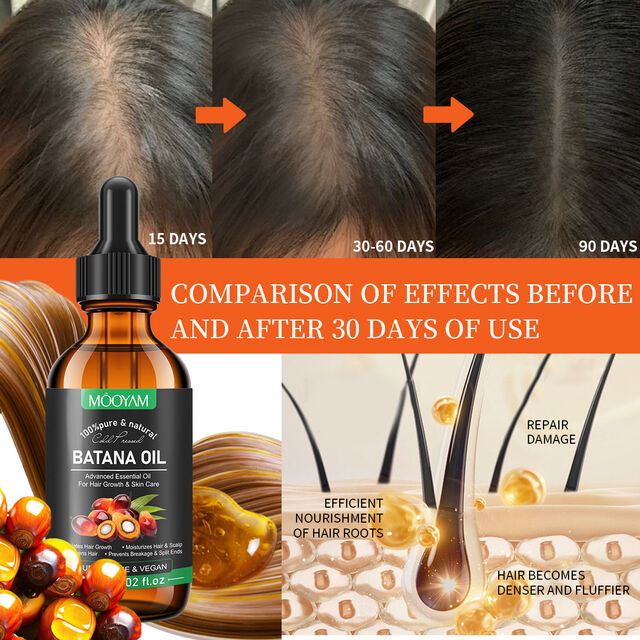 Huile Essentielle Avancée Stimule la Croissance des Cheveux, Hydrate Cheveux & Cuir Chevelu - Huile de Batana MOOYAM pour la Croissance et les Soins des Cheveux