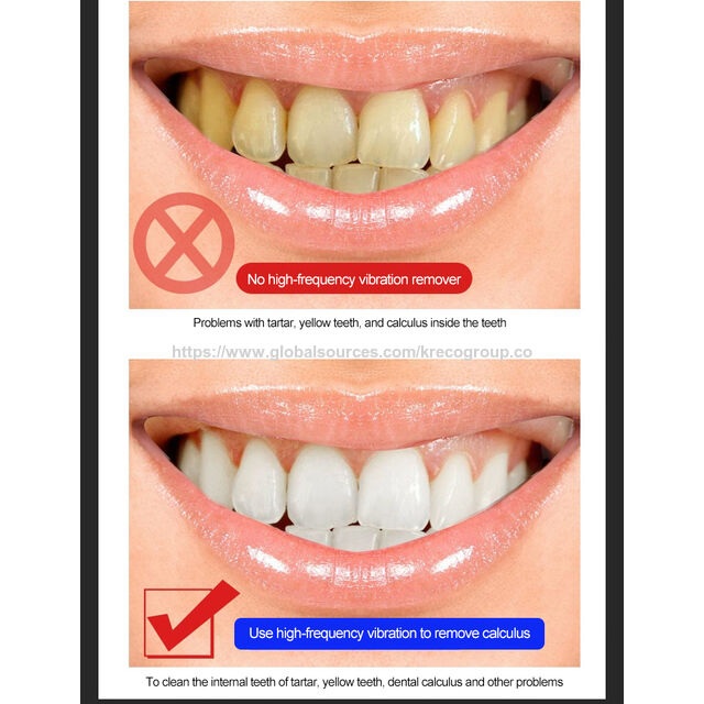 Pencuci Mulut Portabel Cerdas, Pembilas Mulut, Pembilas Mulut Elektrik, Flosser Gigi T-Surf T3