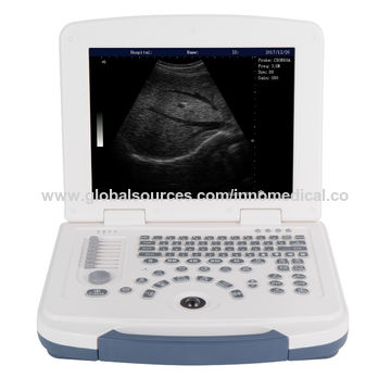 China Medical Portable 3D/4D OB/GYN Ultrasound Machine SUN-800D on ...