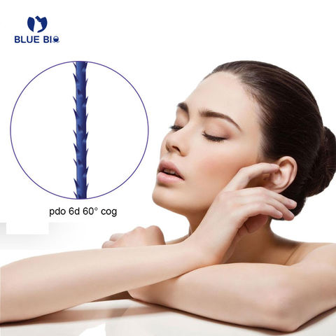 China Blue Bio Korea Absorbable L Needle Barbed Cog Vline Lift Face ...