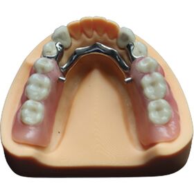 Fabricants dentaires de couronne d'enfant temporaire personnalisés en  Chine, usine - Liste de prix de gros - DTC