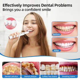 Nueva Tendencia Quitamanchas Sarro Placa Blanqueamiento Limpiador Bucal Máquina Removedor de Placa Kit de Limpieza Removedor de Cálculo Dental T4