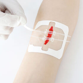 ISO13485 Approved Wound Care Skin Closure Strips Sterile Non-Woven Easy Tear Surgical Dressing for Hospital Surgical Use