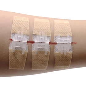 Skin-Friendly Medical Adhesive Suture Material Strong Strips CE Approved Breathable Disposable Wound Closure